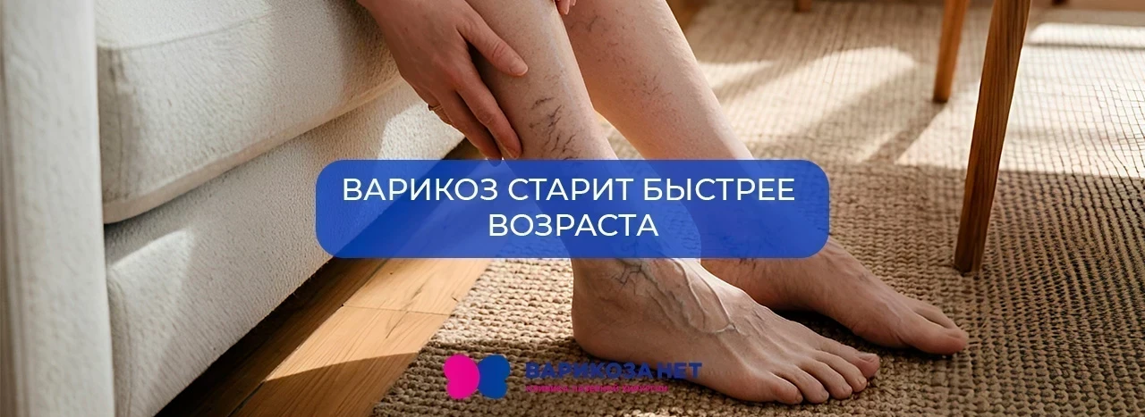 Варикоз старит быстрее возраста