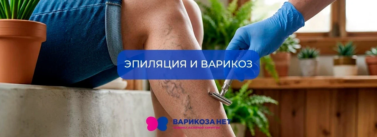 Эпиляция и варикоз: как не навредить красоте ног?